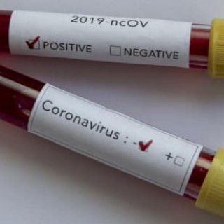 Corona Virüs Türkiye
